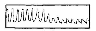 Fig. 85.
